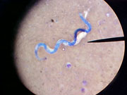 Microfilia