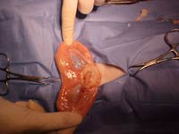 Pyometa surgery