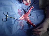 Pyometa surgery